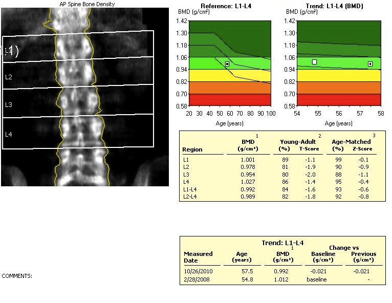 BMD Spine